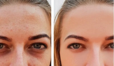 MEN EXPERT - ROLLER ANTI OJERAS