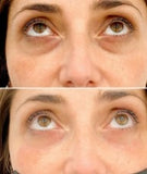 MEN EXPERT - ROLLER ANTI OJERAS